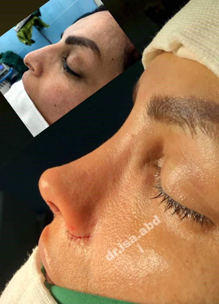 دکتر عیسی عبدی