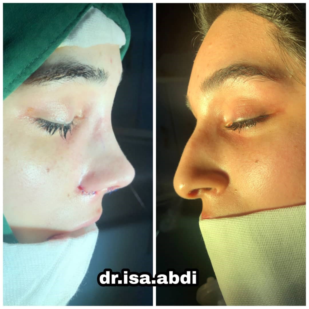 دکتر عیسی عبدی