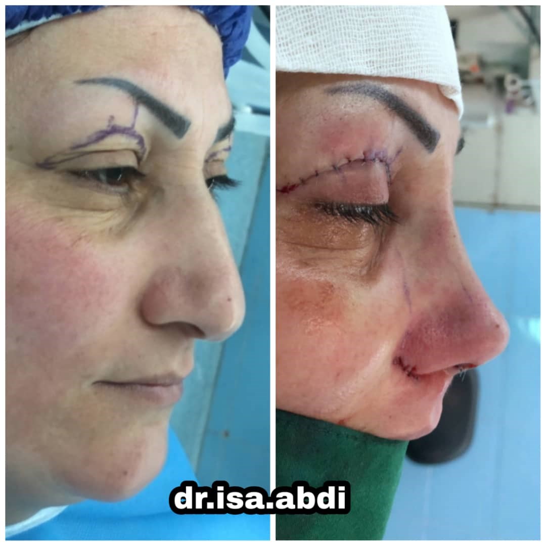 دکتر عیسی عبدی