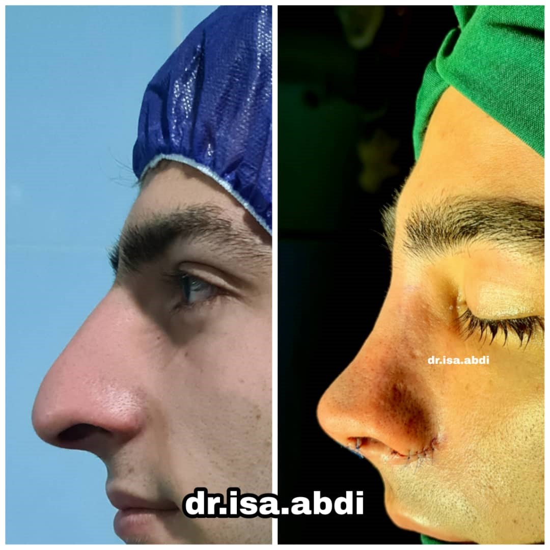 دکتر عیسی عبدی