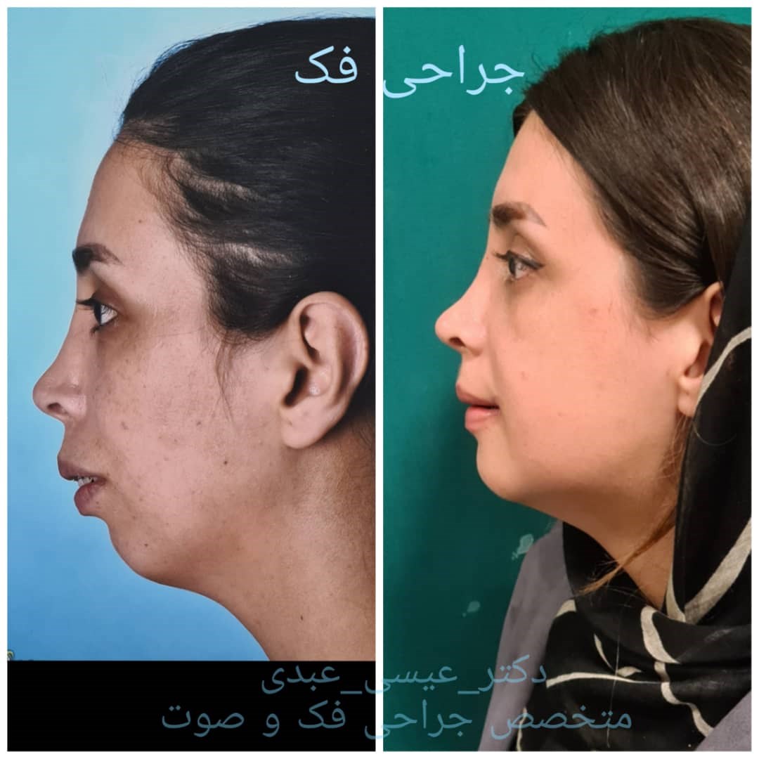 دکتر عیسی عبدی