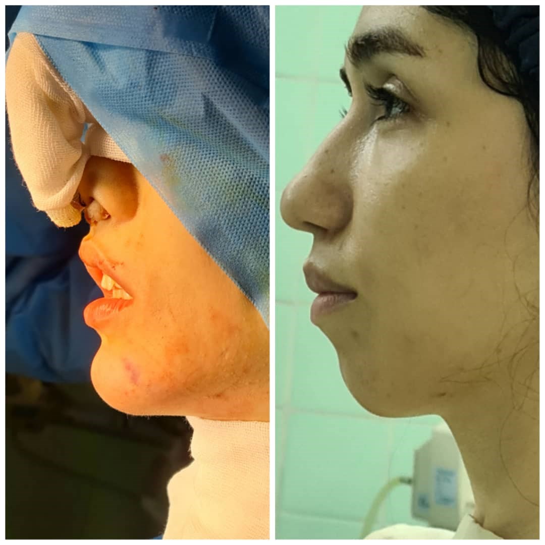 دکتر عیسی عبدی