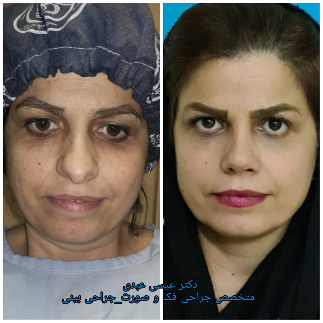 دکتر عیسی عبدی