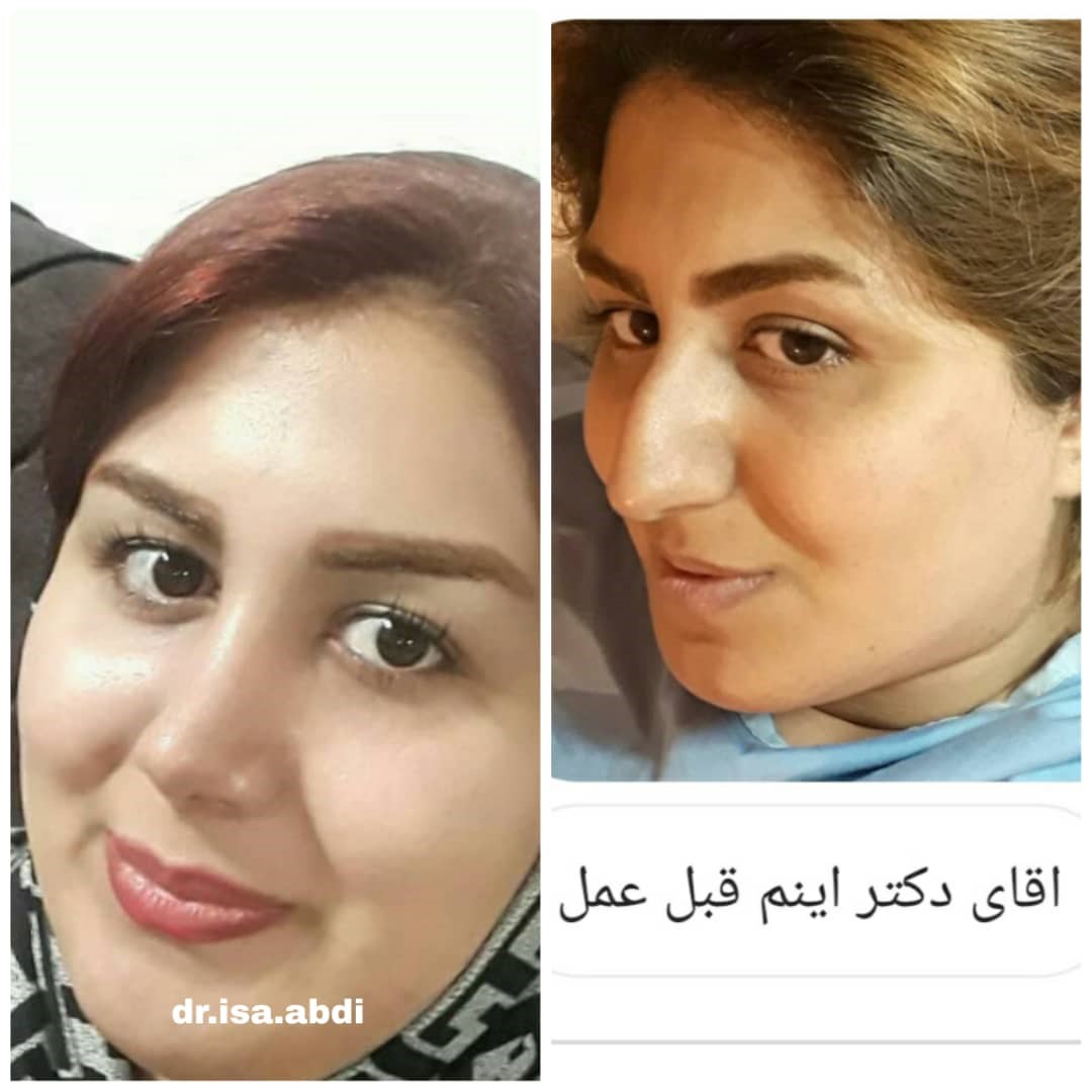 دکتر عیسی عبدی