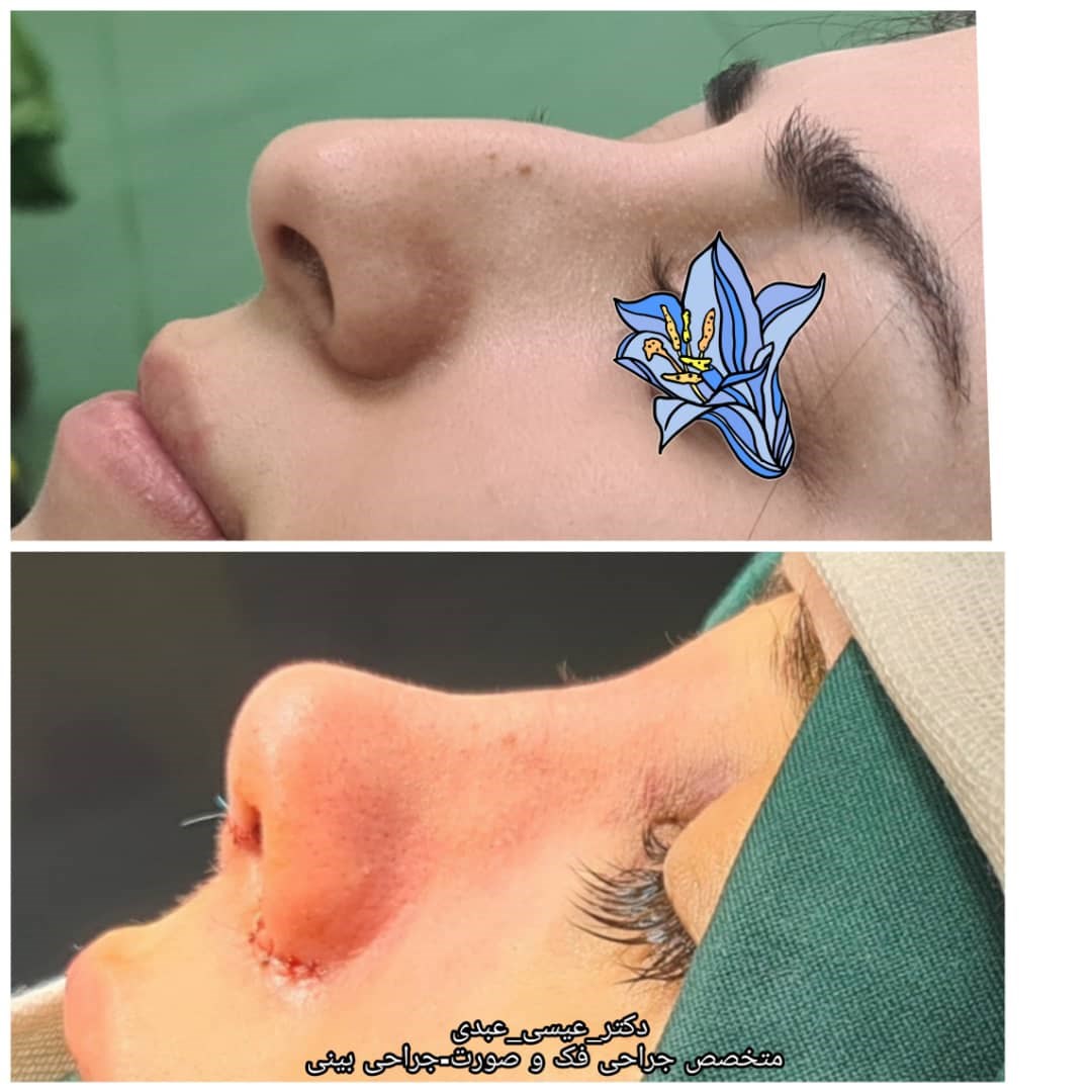 دکتر عیسی عبدی