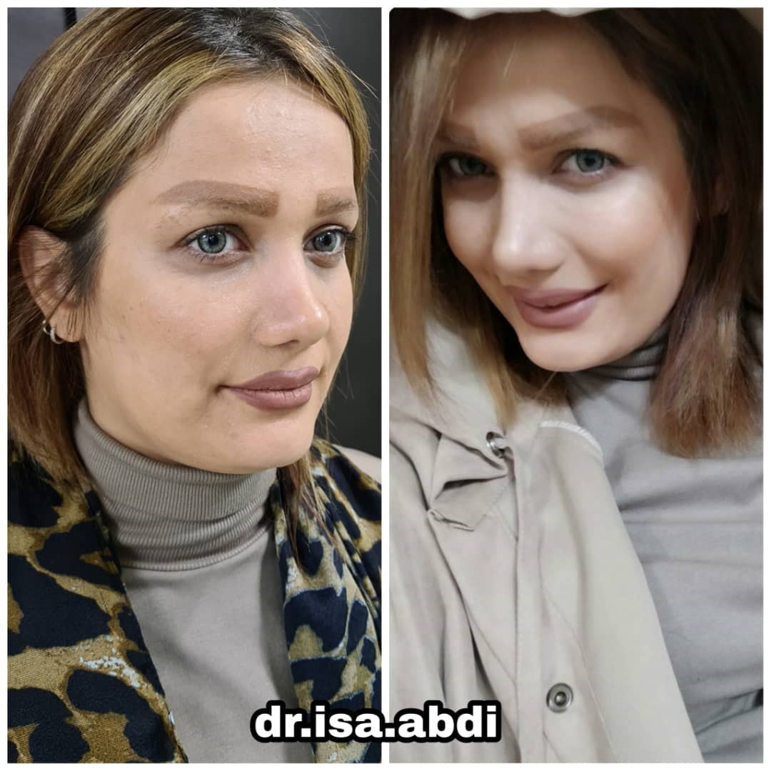 دکتر عیسی عبدی