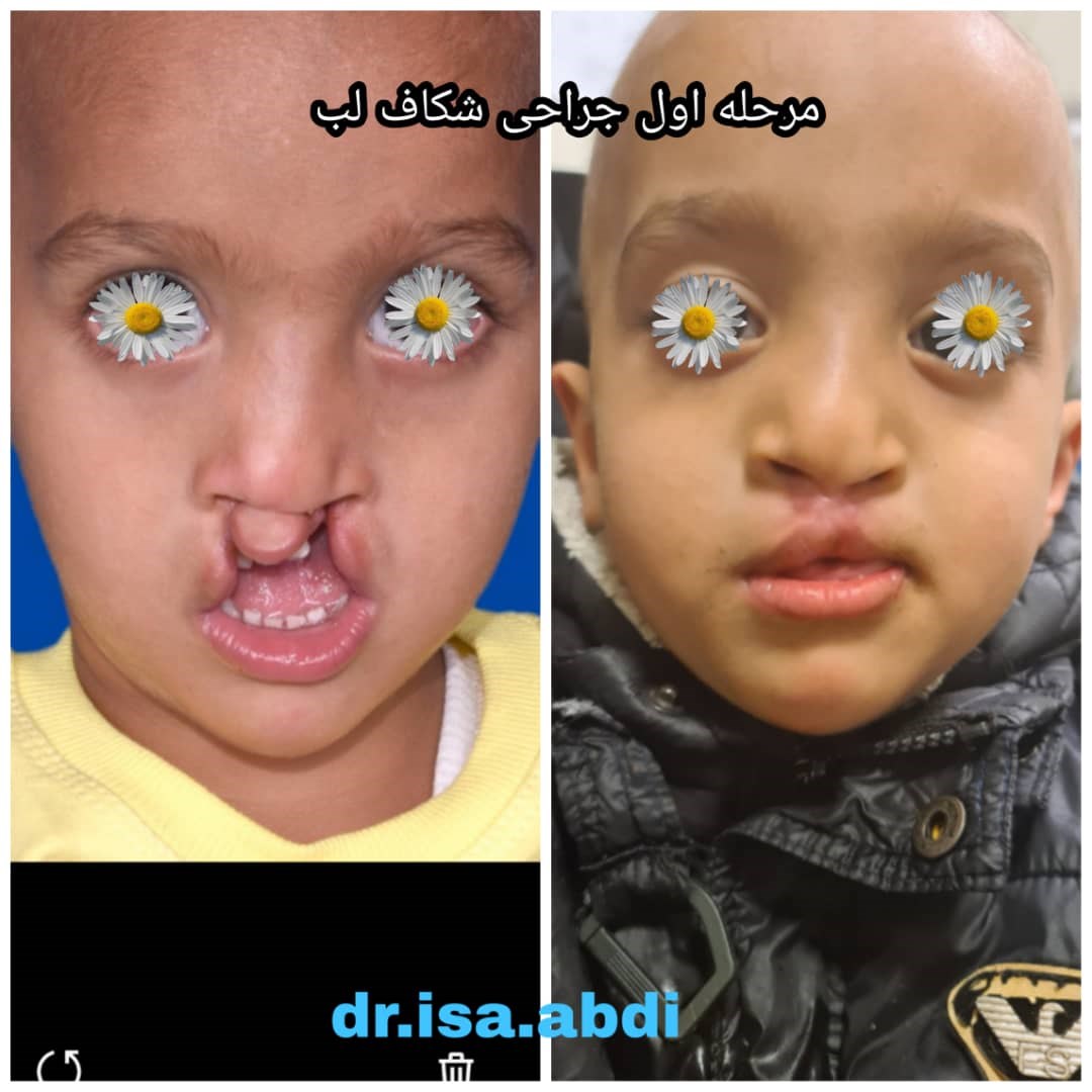 دکتر عیسی عبدی