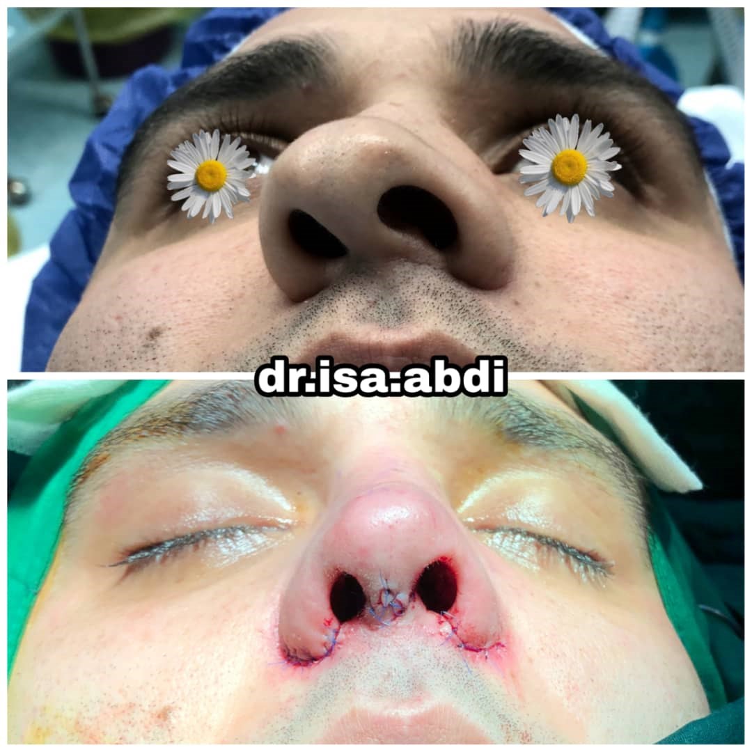 دکتر عیسی عبدی