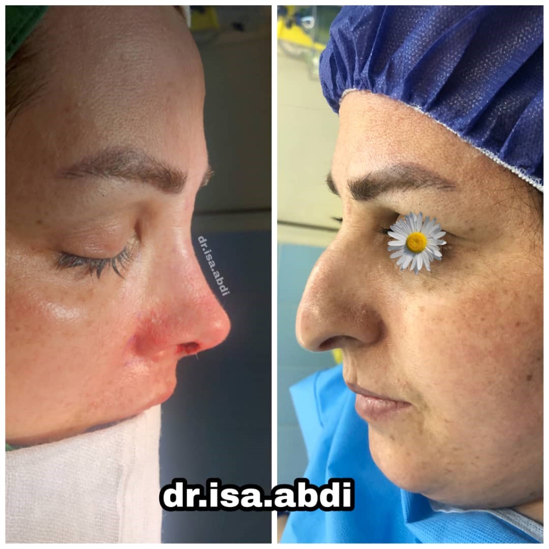 دکتر عیسی عبدی