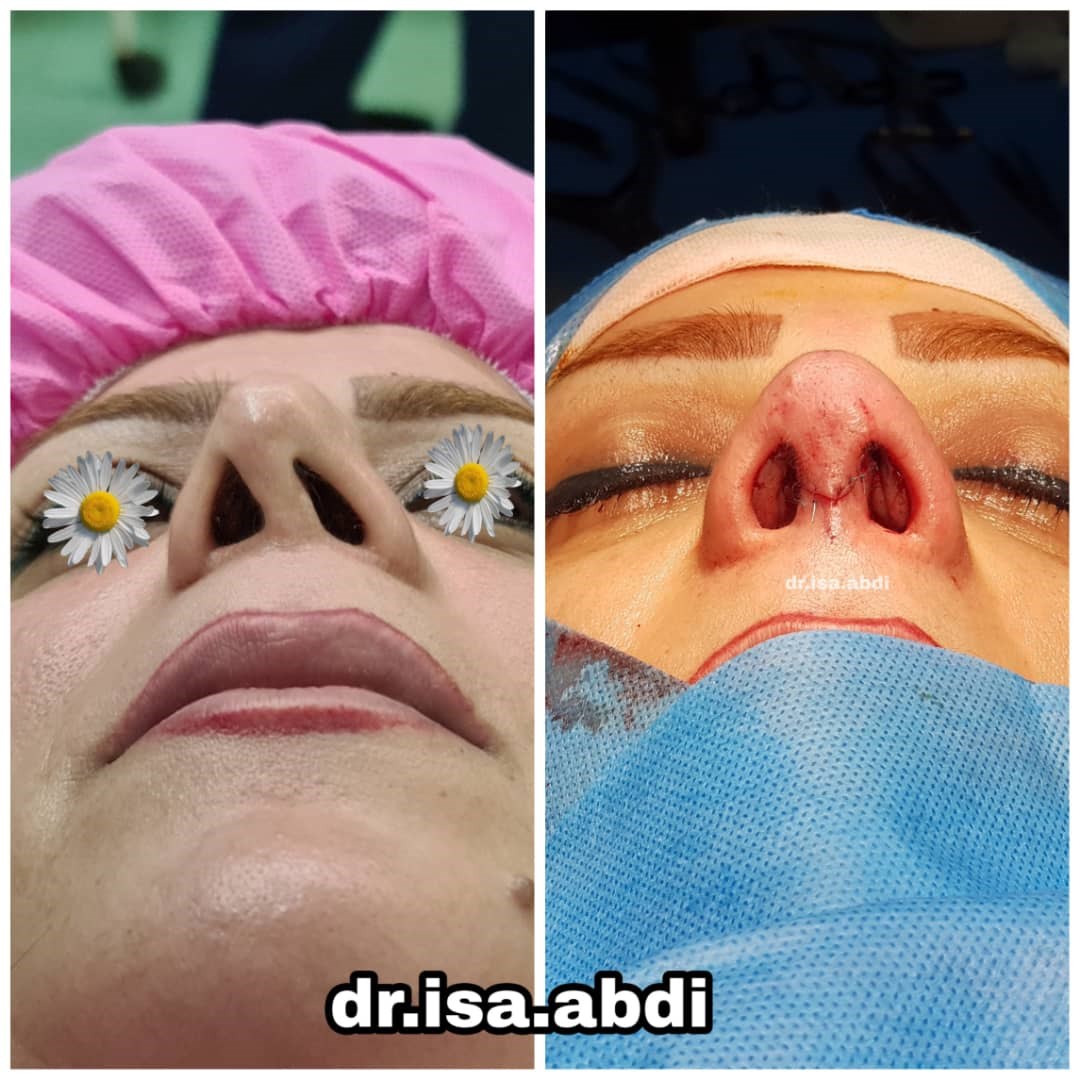 دکتر عیسی عبدی