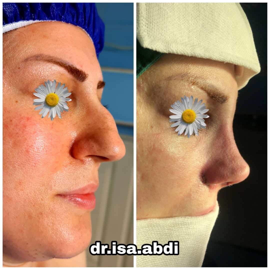 دکتر عیسی عبدی