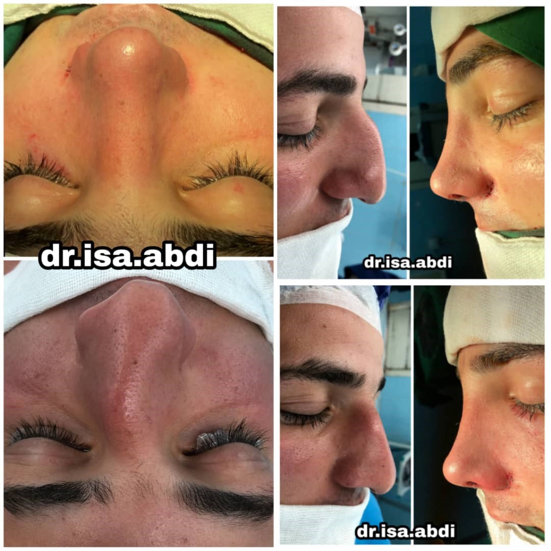 دکتر عیسی عبدی