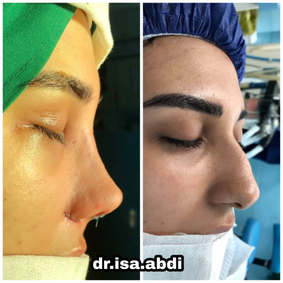 دکتر عیسی عبدی