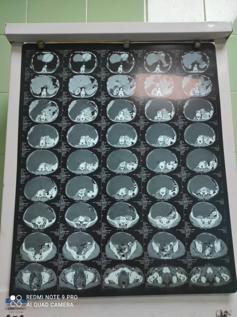 پروفسور سید ضیاء الله حقی