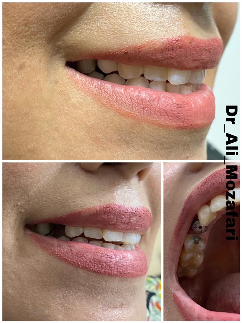 دکترعلی مظفری