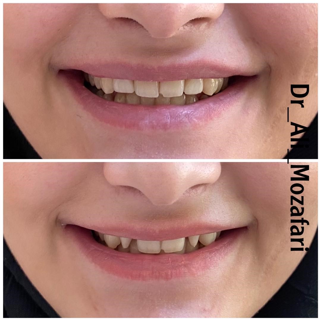 دکترعلی مظفری