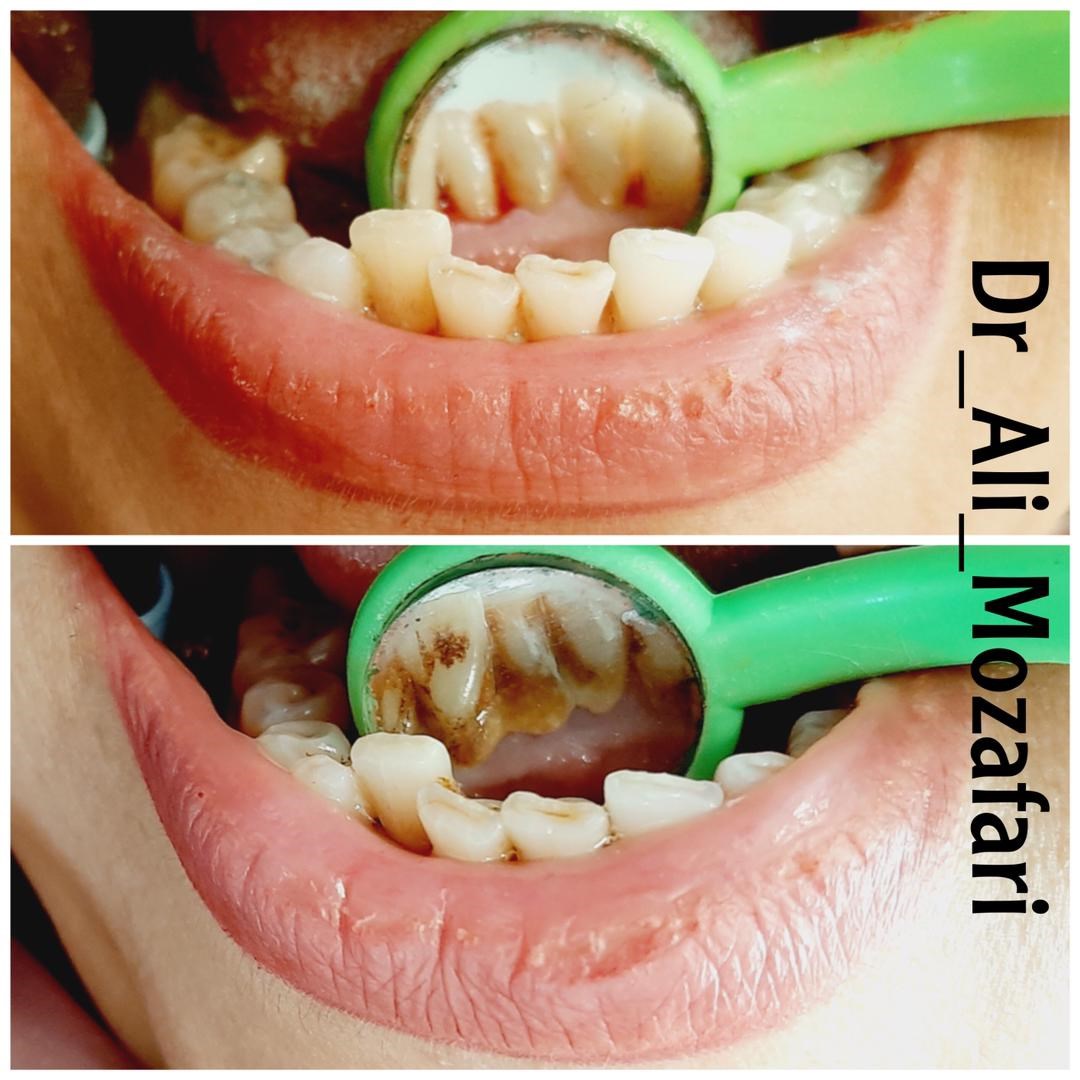 دکترعلی مظفری