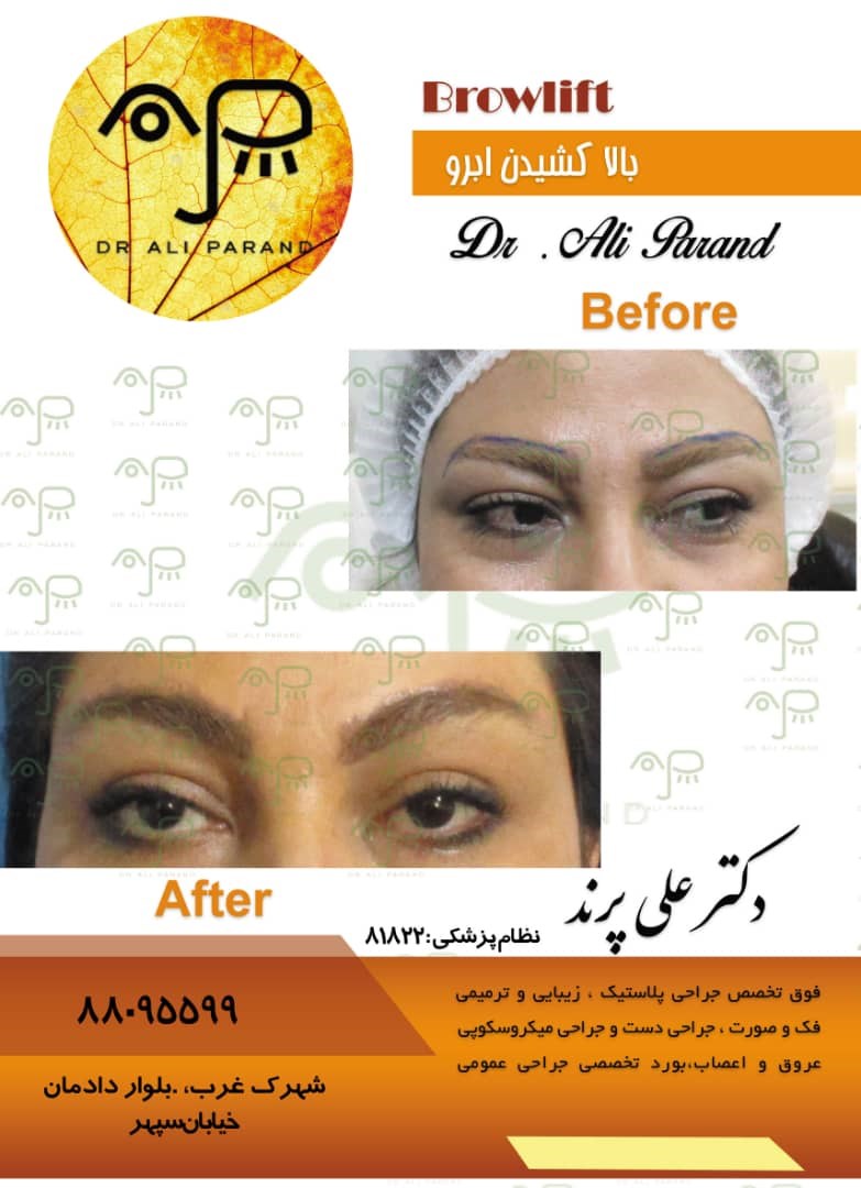 دکترعلی پرند 