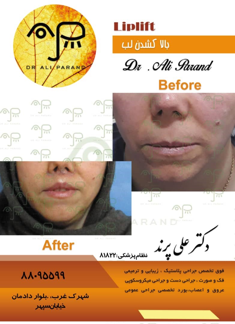 دکترعلی پرند 