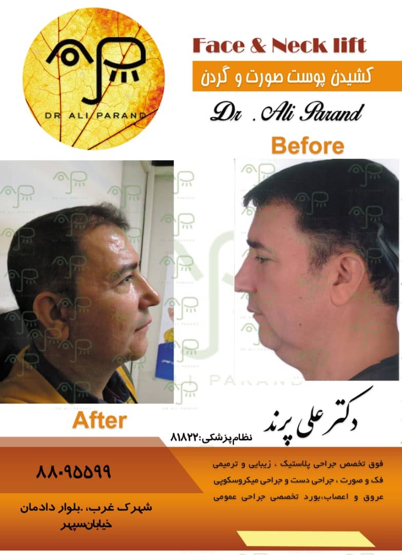 دکترعلی پرند 