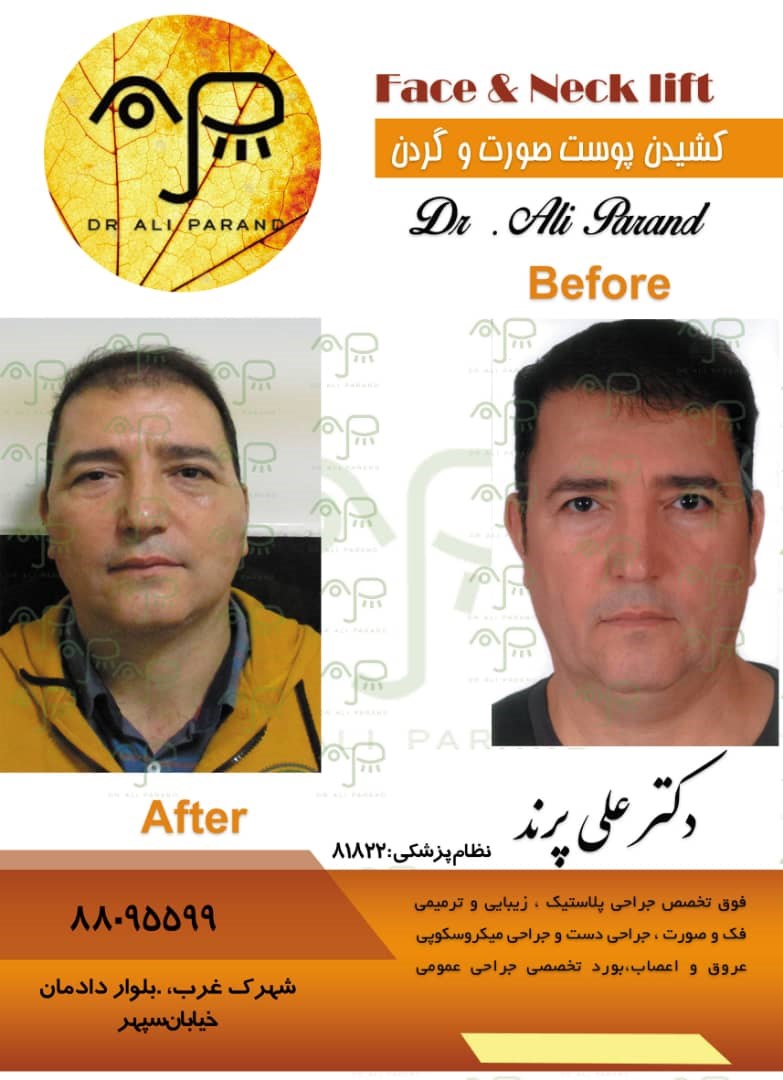 دکترعلی پرند 