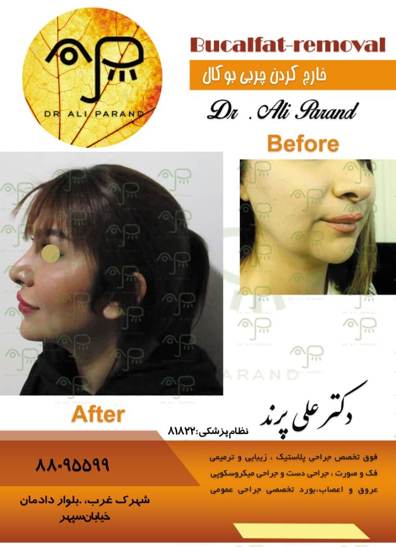 دکترعلی پرند 