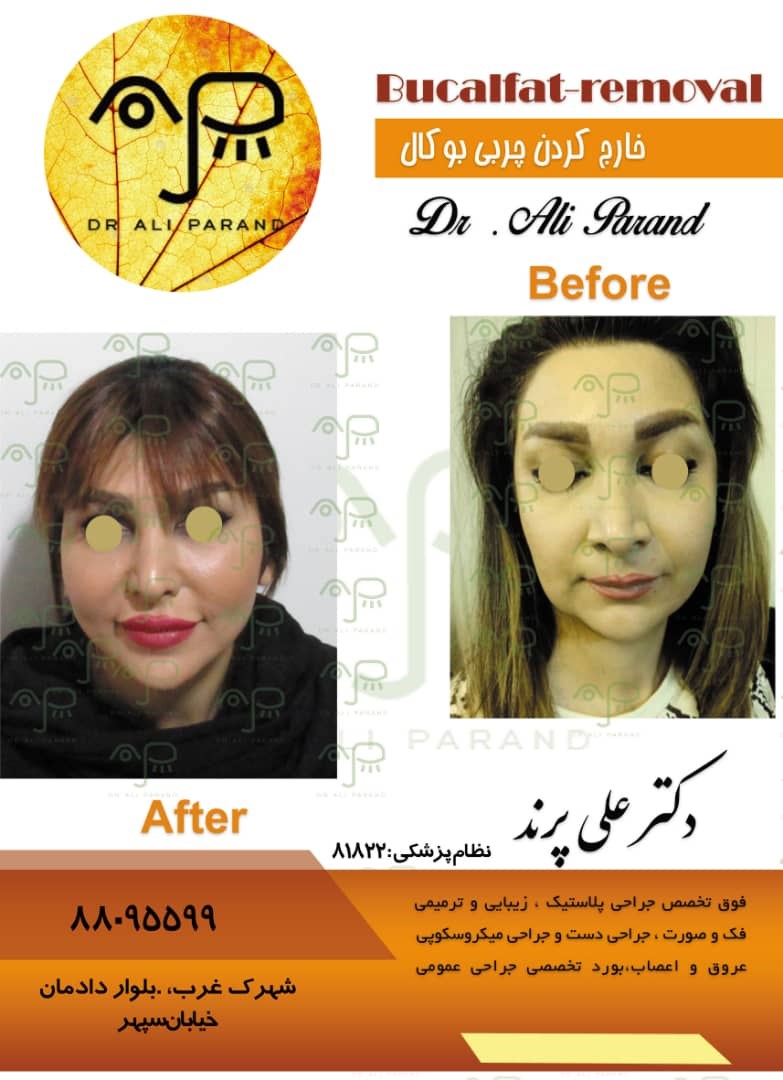 دکترعلی پرند 