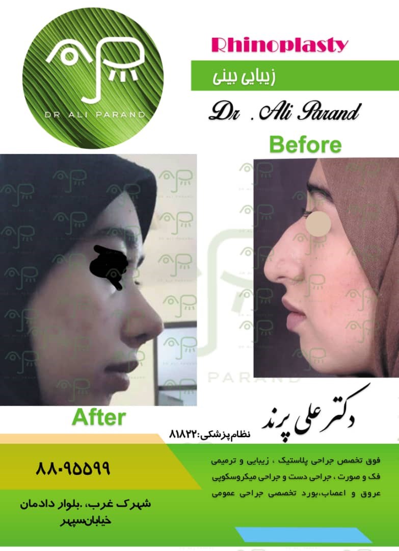 دکترعلی پرند 