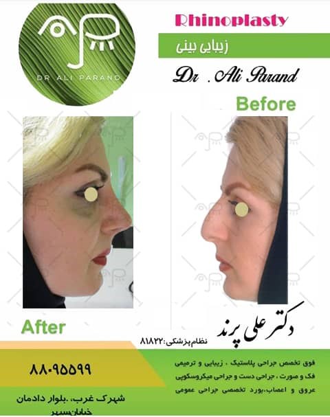 دکترعلی پرند 