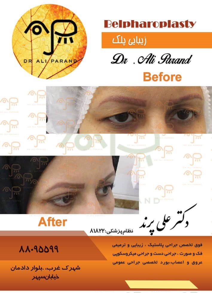 دکترعلی پرند 