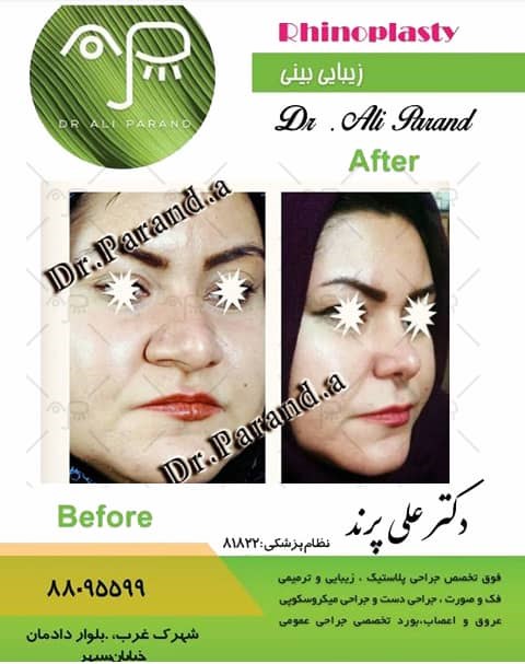 دکترعلی پرند 