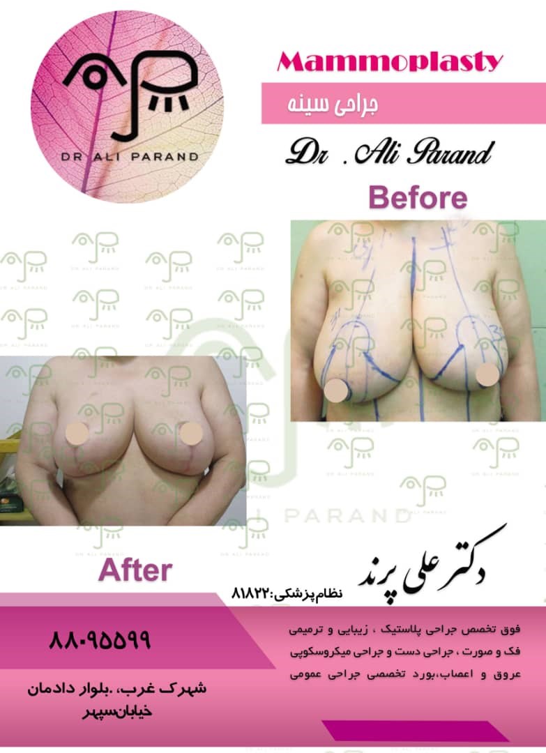 دکترعلی پرند 