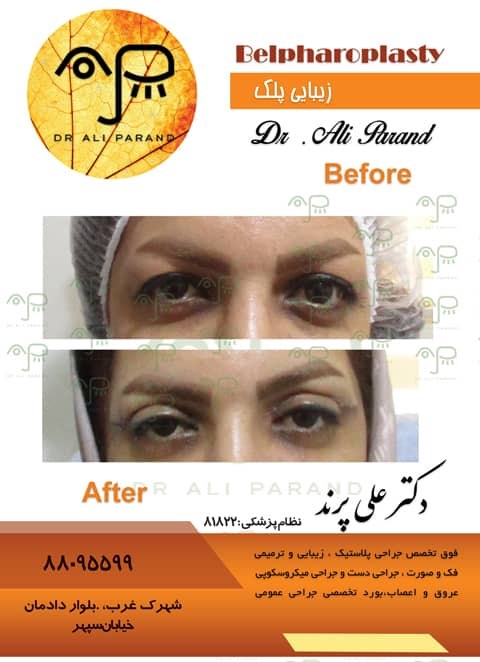 دکترعلی پرند 