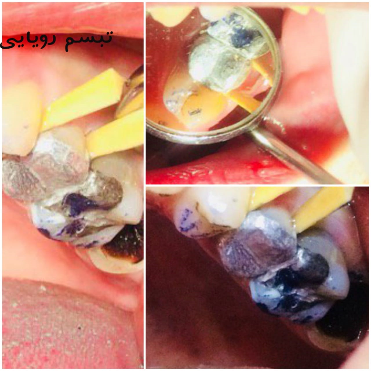 کلینیک دندانپزشکی تبسم رویایی 