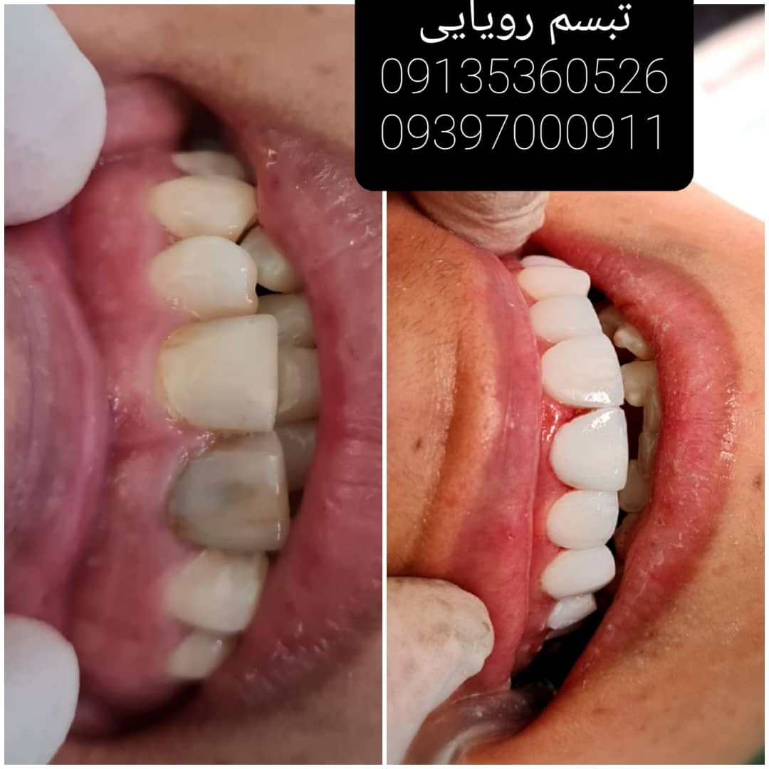 کلینیک دندانپزشکی تبسم رویایی 