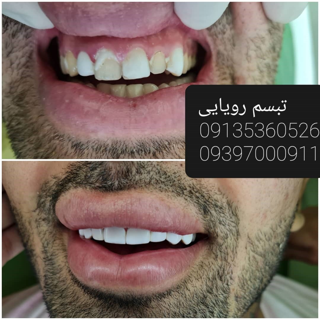 کلینیک دندانپزشکی تبسم رویایی 