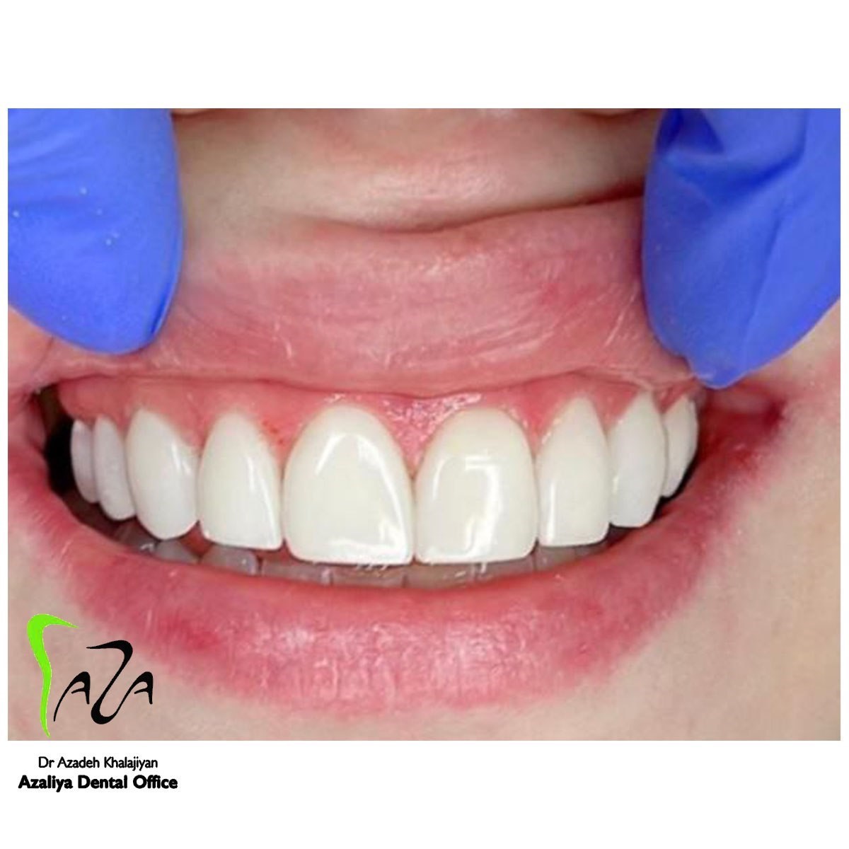 دکترآزاده خلجیان