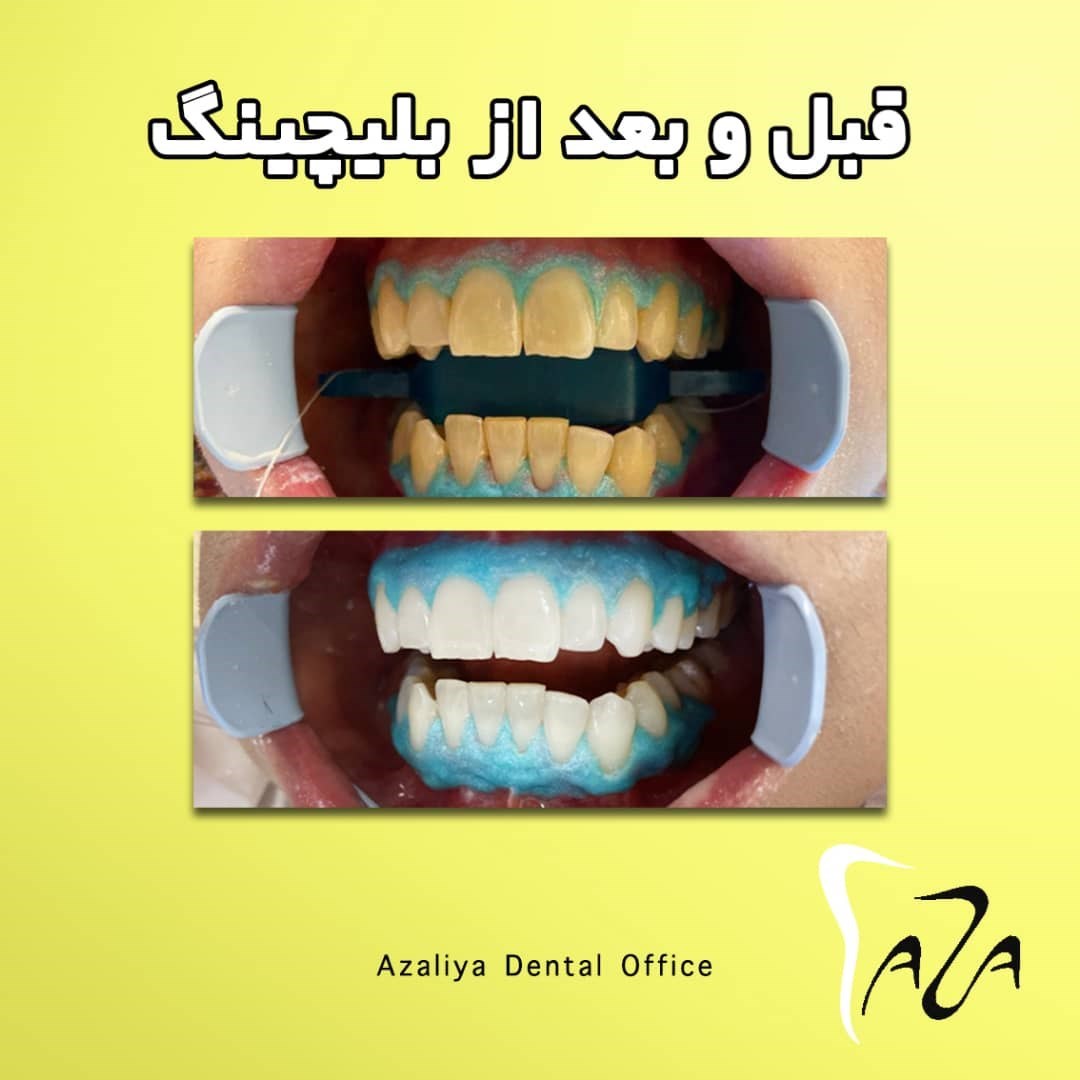 دکترآزاده خلجیان