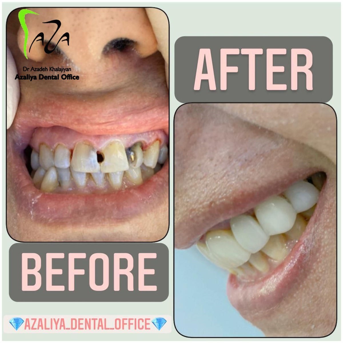 دکترآزاده خلجیان