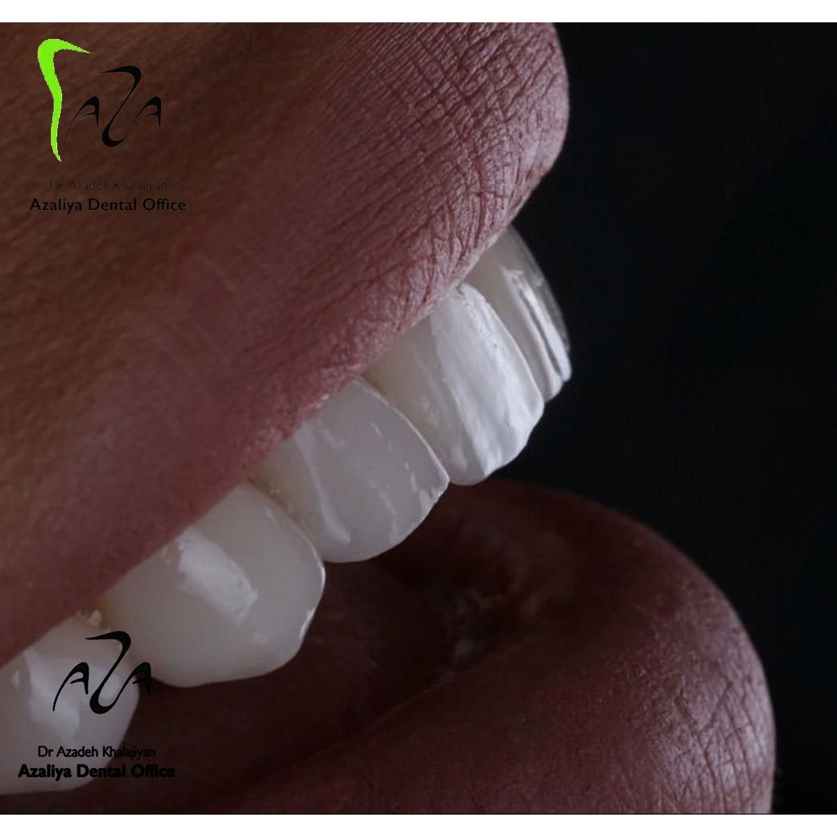 دکترآزاده خلجیان