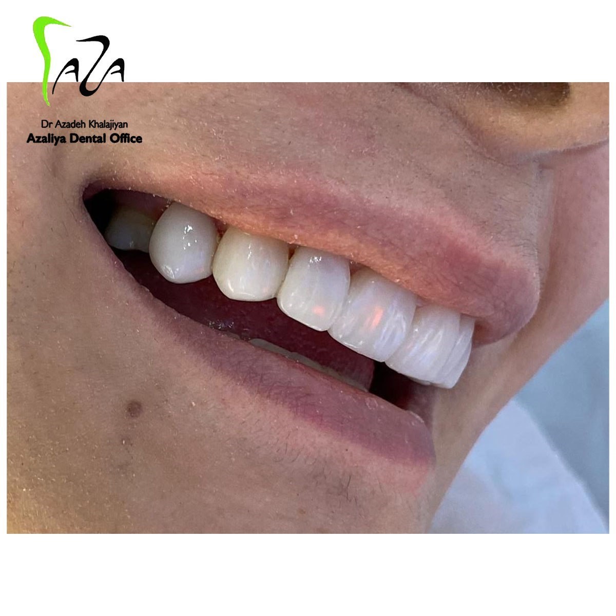 دکترآزاده خلجیان