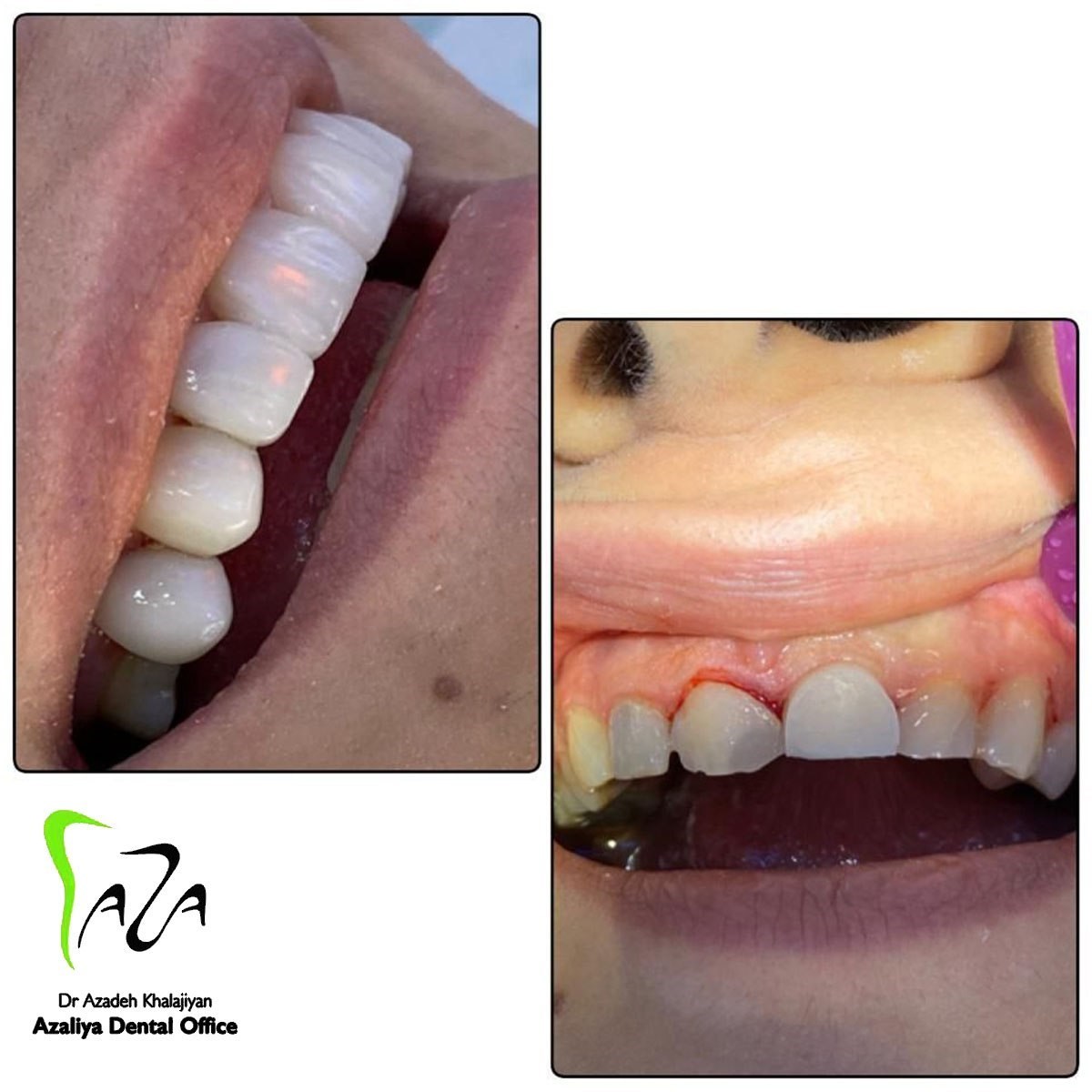 دکترآزاده خلجیان