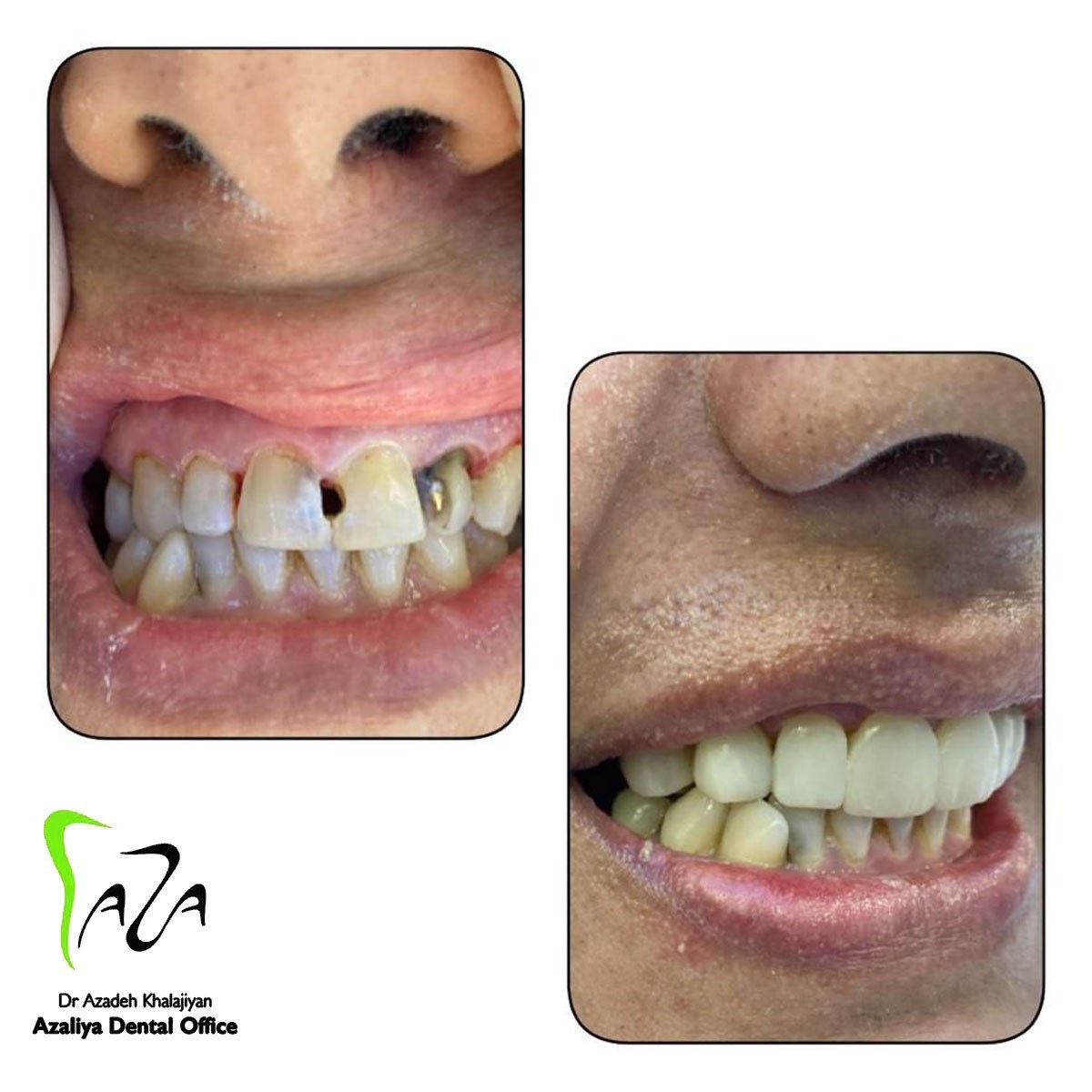 دکترآزاده خلجیان