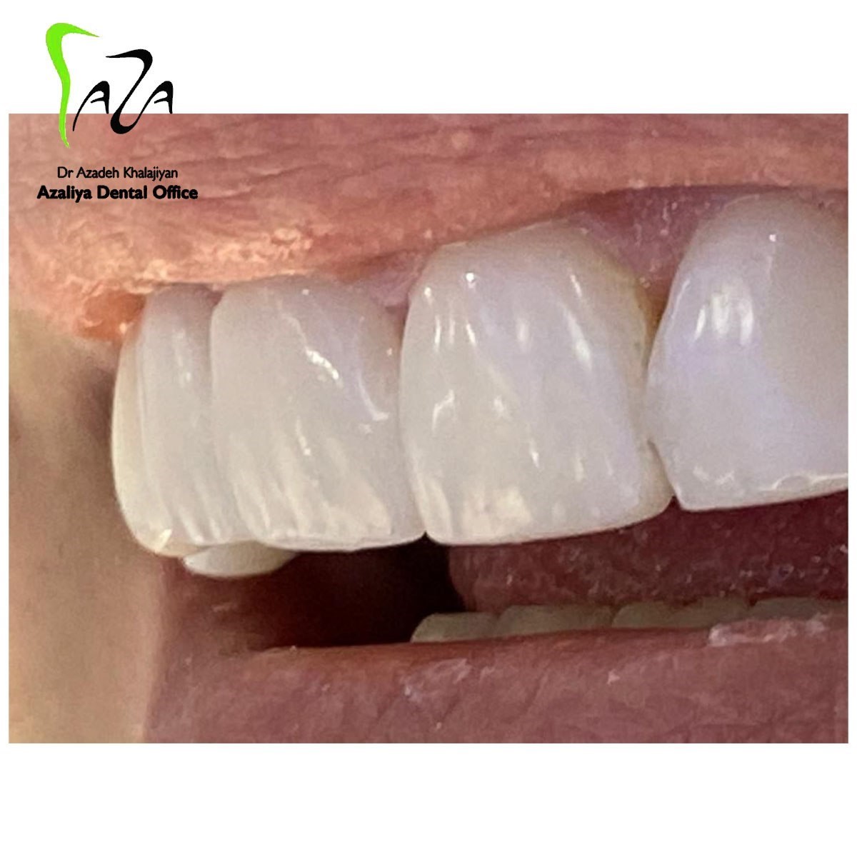 دکترآزاده خلجیان