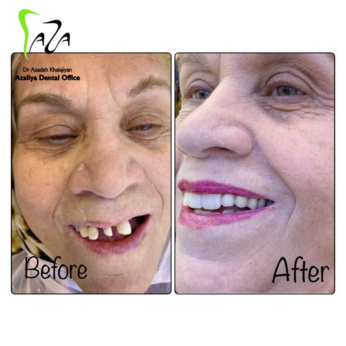 دکترآزاده خلجیان