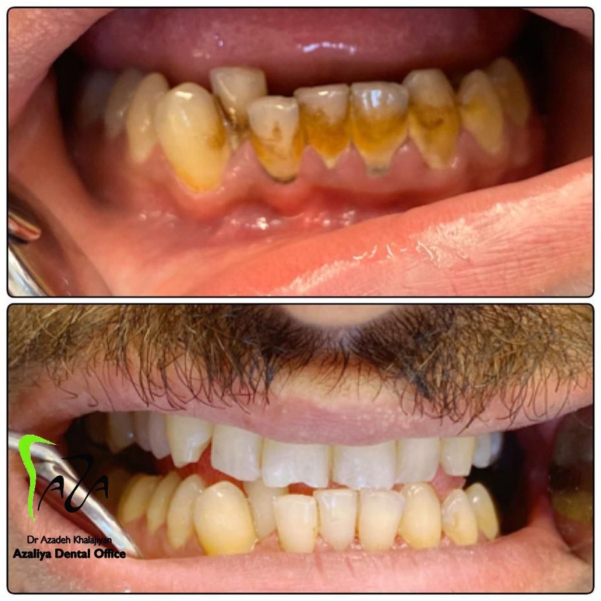 دکترآزاده خلجیان