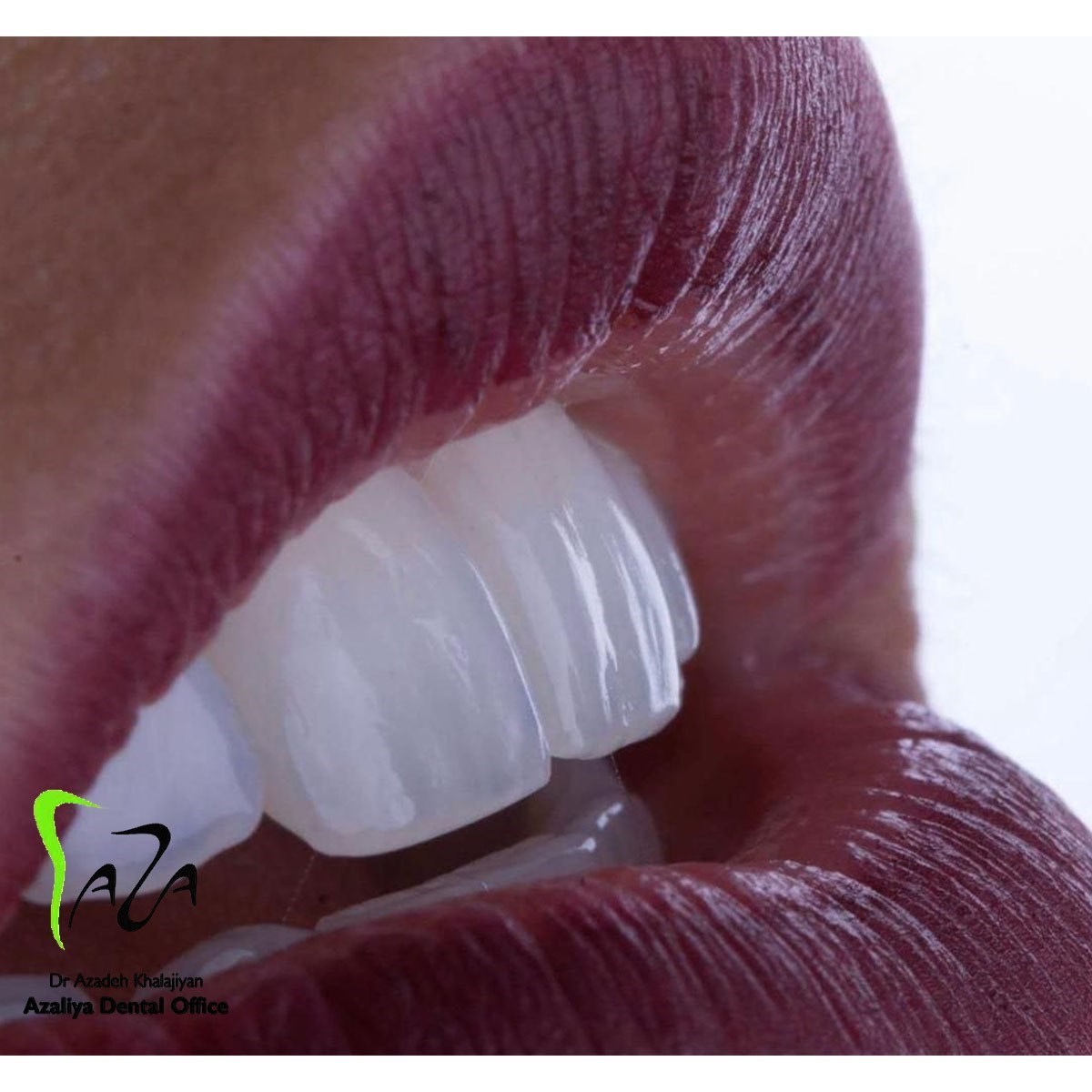 دکترآزاده خلجیان