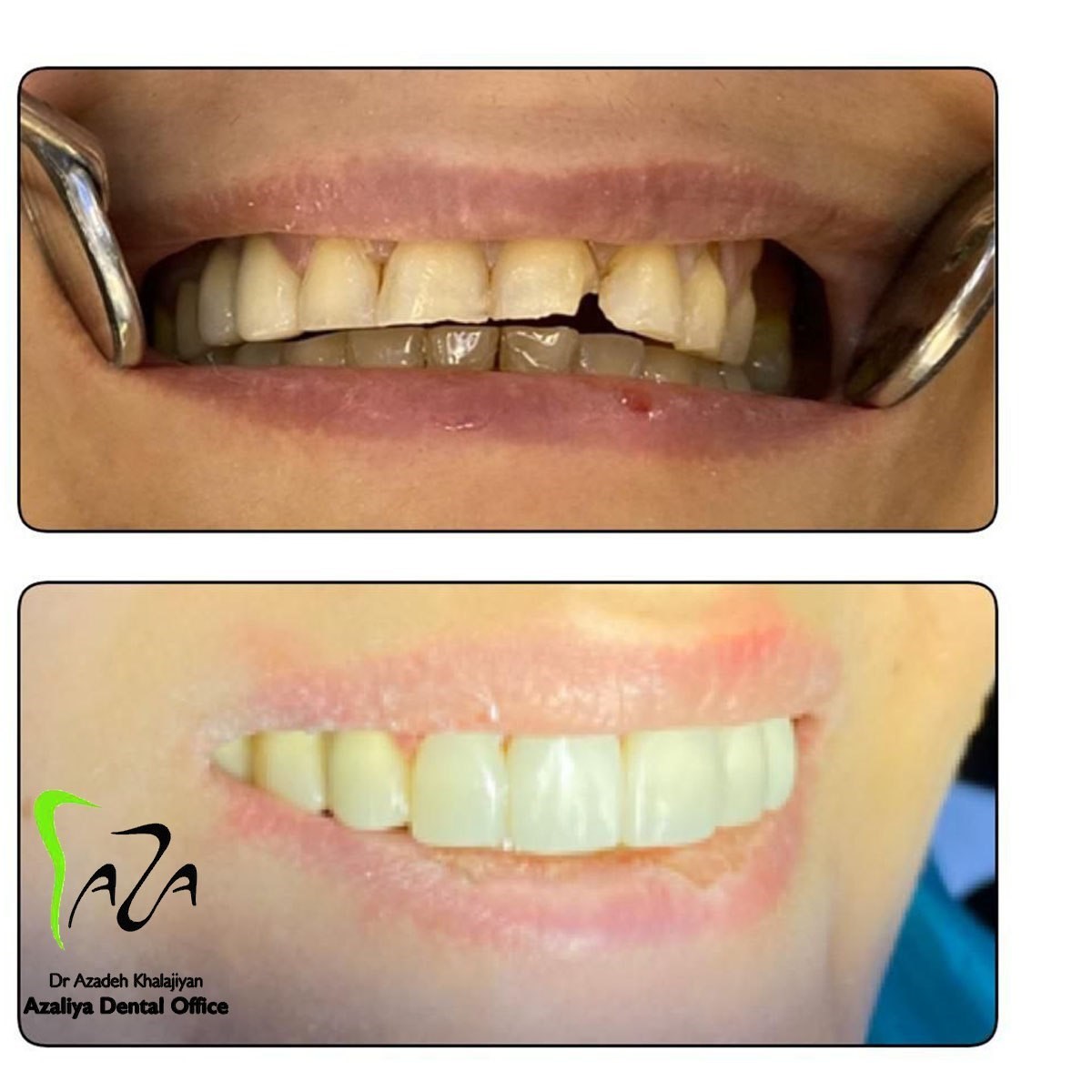 دکترآزاده خلجیان