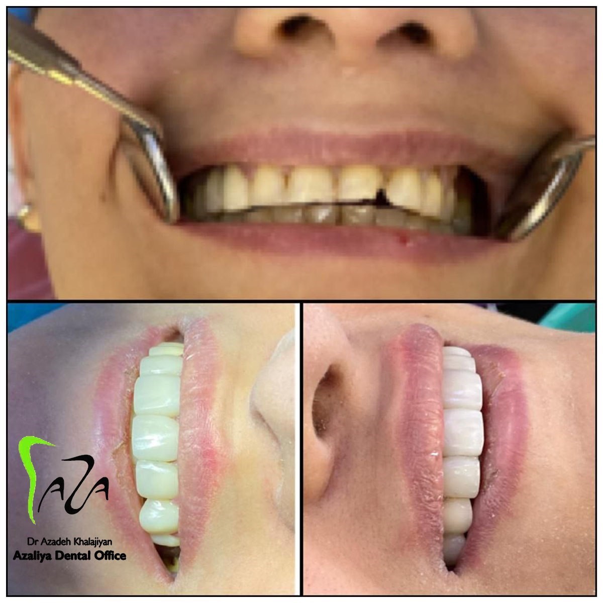 دکترآزاده خلجیان