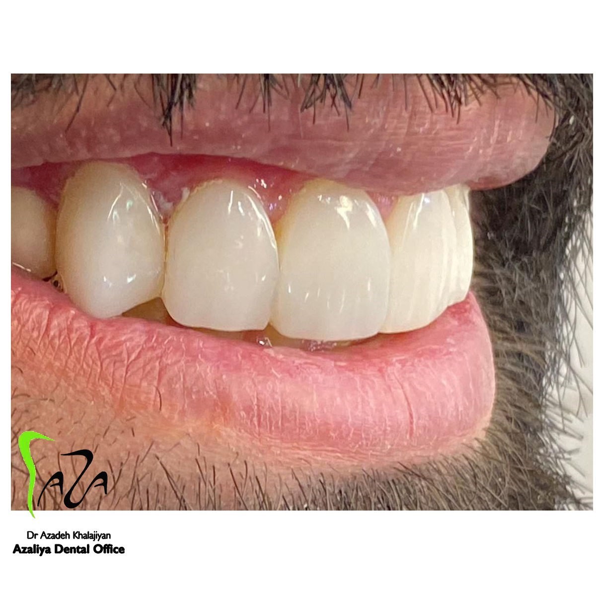 دکترآزاده خلجیان